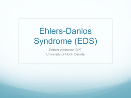 Ehlers-Danlos Syndrome (EDS) - Robert Whittaker