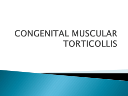 CONGENITAL MUSCULAR TORTICOLLIS Definition