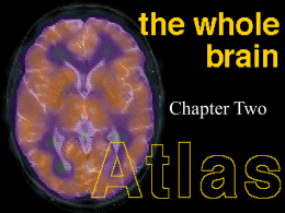 Brain Presentation1