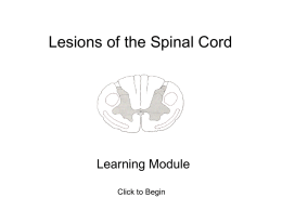 Spinal Cord Injury Lesions
