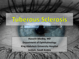 Tuberous Sclerosis