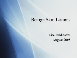 Benign Skin Lesions - Medical Student LC