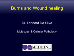 Burns and Wound healing - UQMBBS-2013