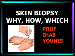 Every skin nodule should be biopsied 2