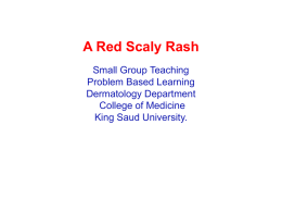 A RED SCALY RASH - King Saud University Medical Student