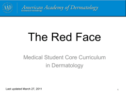 The Red Face - American Academy of Dermatology