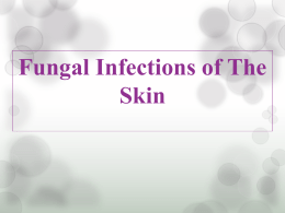 fungal infections of the skin (1)x