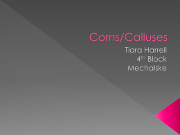 Corns/Calluses - mechalskesbiology