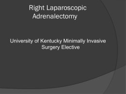Right Laparoscopic Adrenalectomy