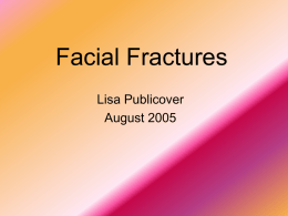 Facial Fractures - Medical Student LC