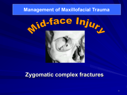 zygomatio-frontal Fracture