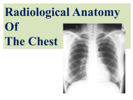 L5- X-ray chest