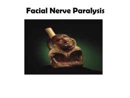 cross-facial nerve graft