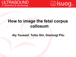 How to image the fetal corpus callosum Aly Youssef, Tullio