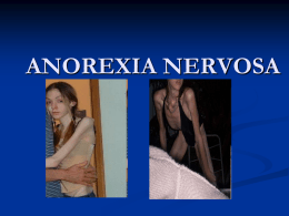 Anorexia nervosa - KolejTuankuJaafar
