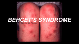 behcet*s syndrome - S3 amazonaws com