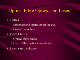 corrective laser eye surgery