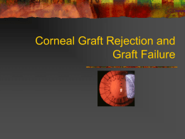 Corneal Graft Rejection