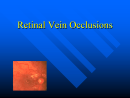 Retinal Vein Occlusions - Kashyap Memorial Eye Hospital India