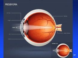presbyopia-conference