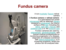 Fundus camera