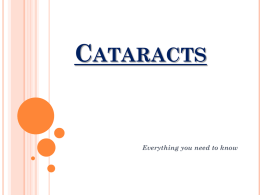 Cataracts - Norman Salmoni Opticians