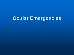 Ocular Emergencies