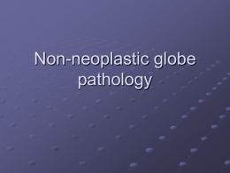 Non-neoplastic globe pathology non-neoplastic globe