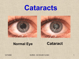 Cataract information.pps