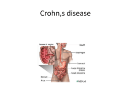 Crohn,s disease