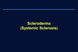 Systemic Sclerosis (Scleroderma)