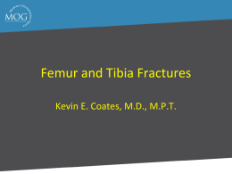 Femur and Tibia Fractures - Memphis Orthopaedic Group