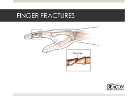 Distal radius fractures