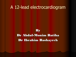 lecture 4 A 12-lead electrocardiogram (ECG)