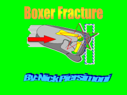 Boxer Fracture - Care and Prevention of Athletic Injuries