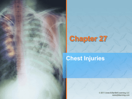 AAOS Chap 27 Chest Injuries PPT