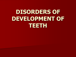 disorders of development of teeth