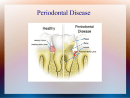Periodontal Disease Patient Profile Patient is a 68 year old male