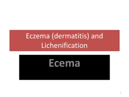 Eczema (dermatitis) and Lichenification
