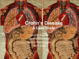 Crohn`s case study