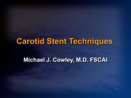 Carotid Stent Technique Dx