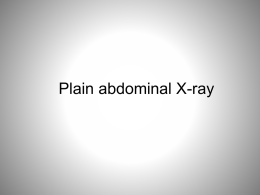Plain abdominal X