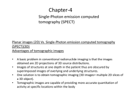 Single-Photon emission computed tomography (SPECT )