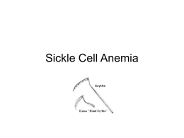 Sickle cell anemia - abnormally shaped red blood cells that are