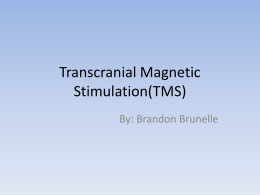 Transcranial Magnetic Stimulation(TMS)