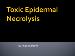 Toxic Epidermal Necrolysis - UNM Biology Department Home Page