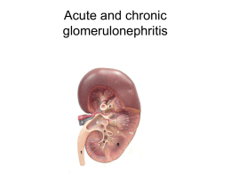 14. Acute and chronic glomerulonephritis