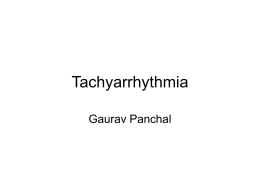 Tachyarrhythmia