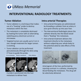 Interventional Radiology Treatments