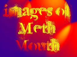 Before and After Images of Meth Mouth